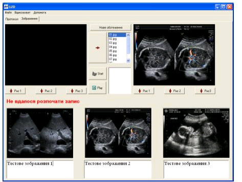 Комп'ютерна програма для автоматизації робочого місця лікаря ультразвукової діагностики (УЗД)